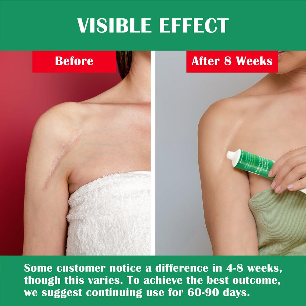 Ladygo Advance Scar Gel on face shows lightweight, non-sticky texture for facial scar care