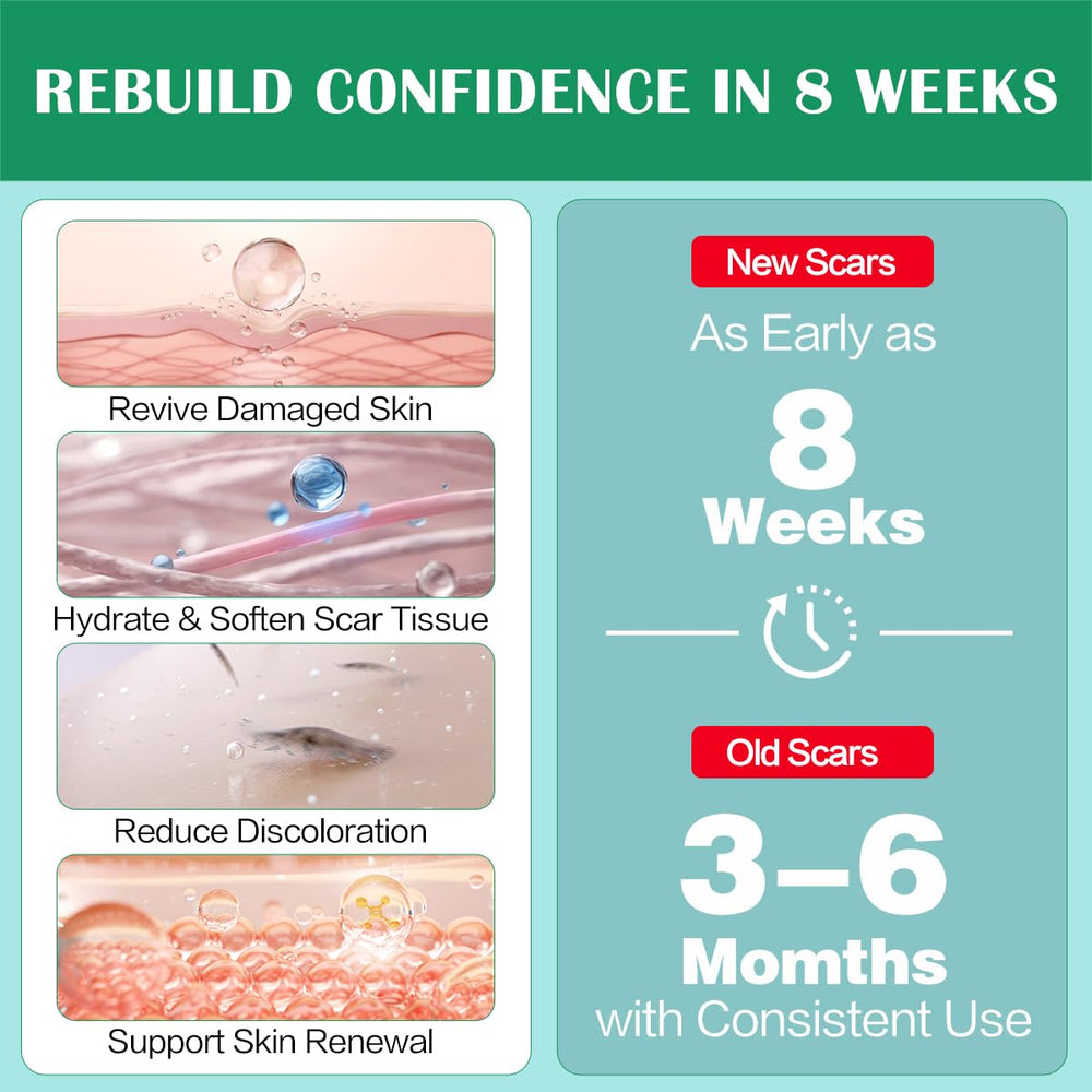 Ladygo Advance Scar Gel with Vitamin E and Allantoin boosts healing while you apply