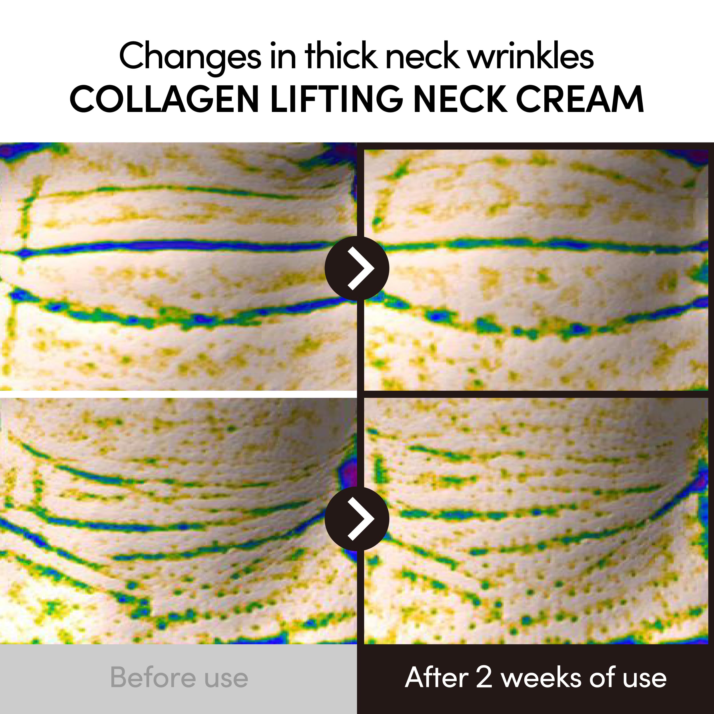 LAGOM collagen lifting neck cream packaging highlights premium Korean skincare.