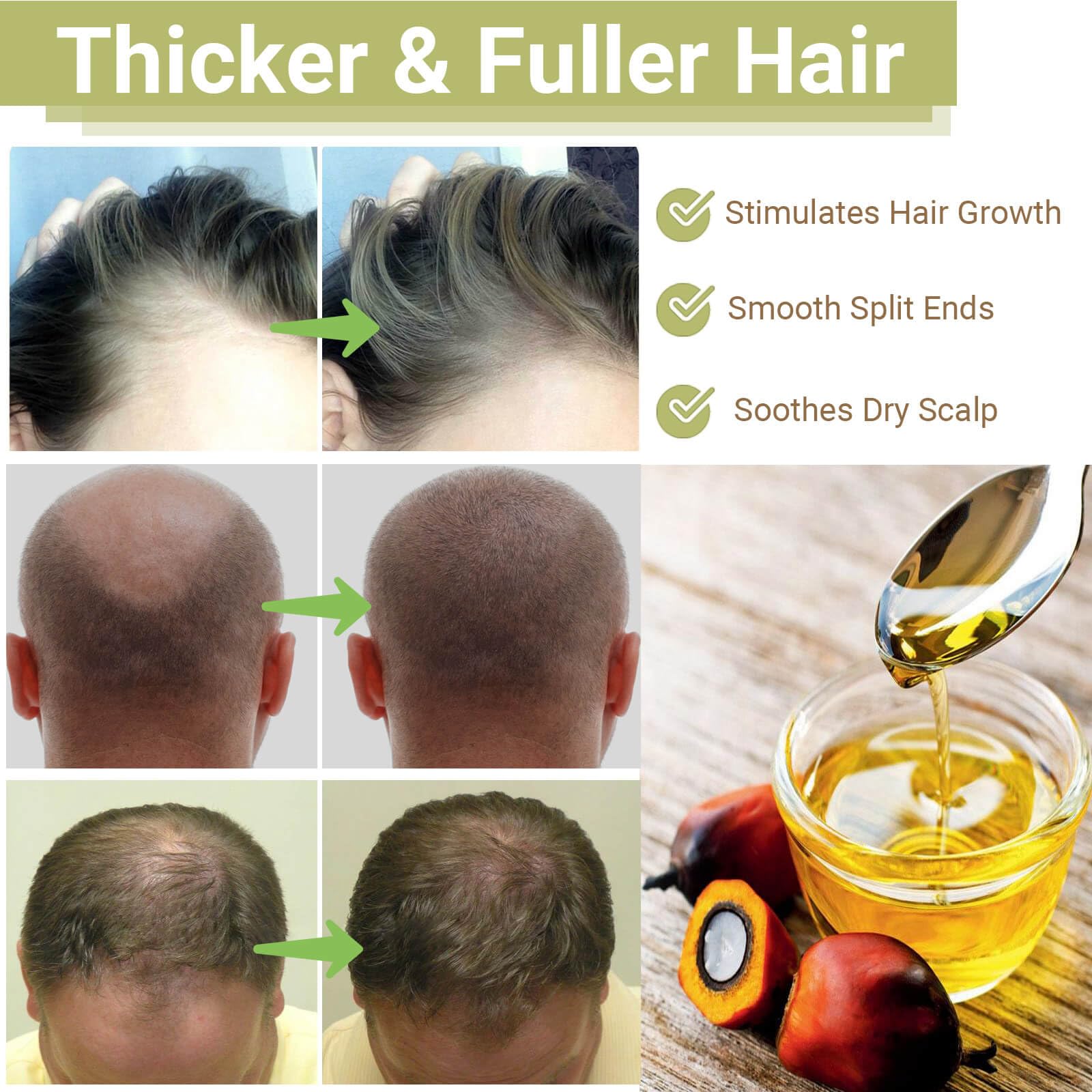 Lampolar Batana Oil hydrates dry scalp for improved elasticity