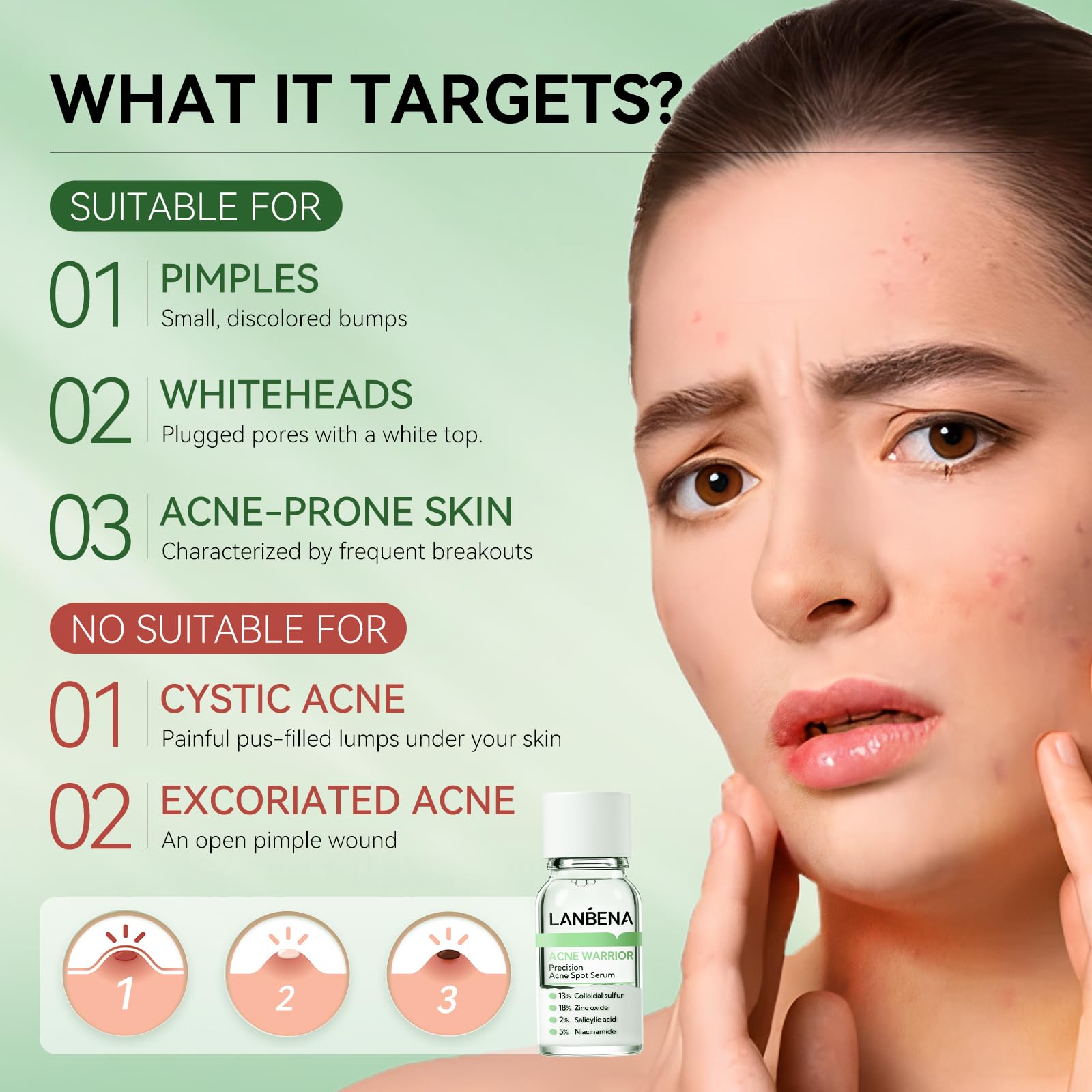 LANBENA Acne Spot Serum application on the face demonstrating spot treatment
