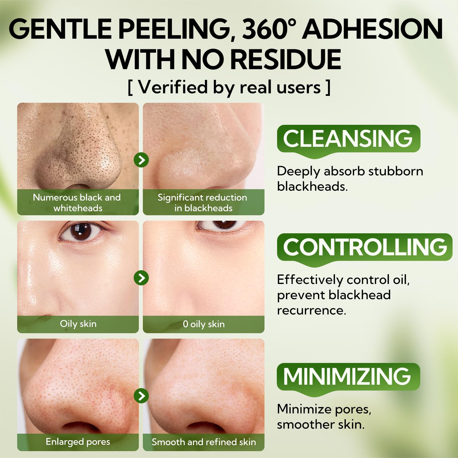 LANBENA after-use skin closeup showing refreshed, clean pores