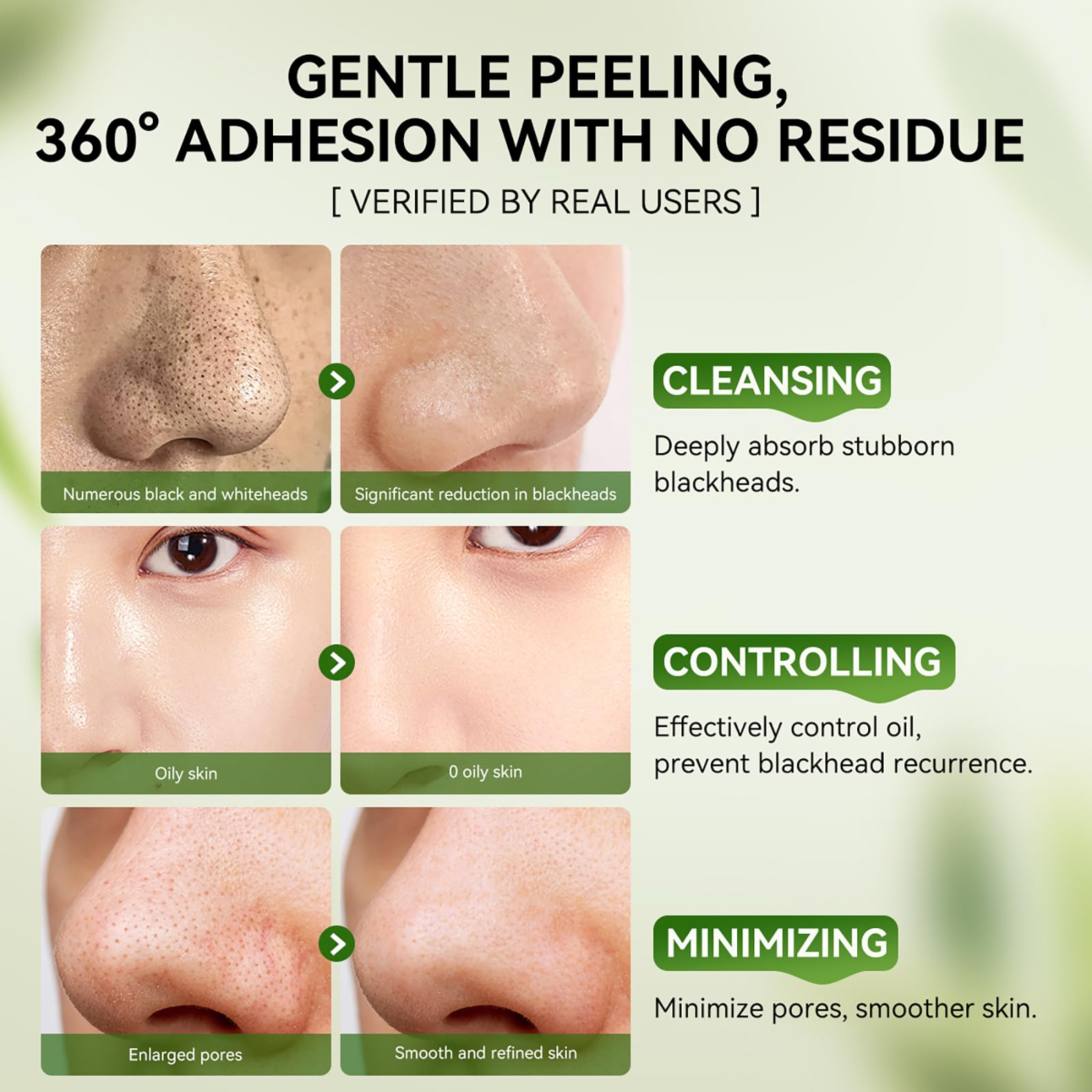 LANBENA Clear pores with adsorbed impurities using the strips.