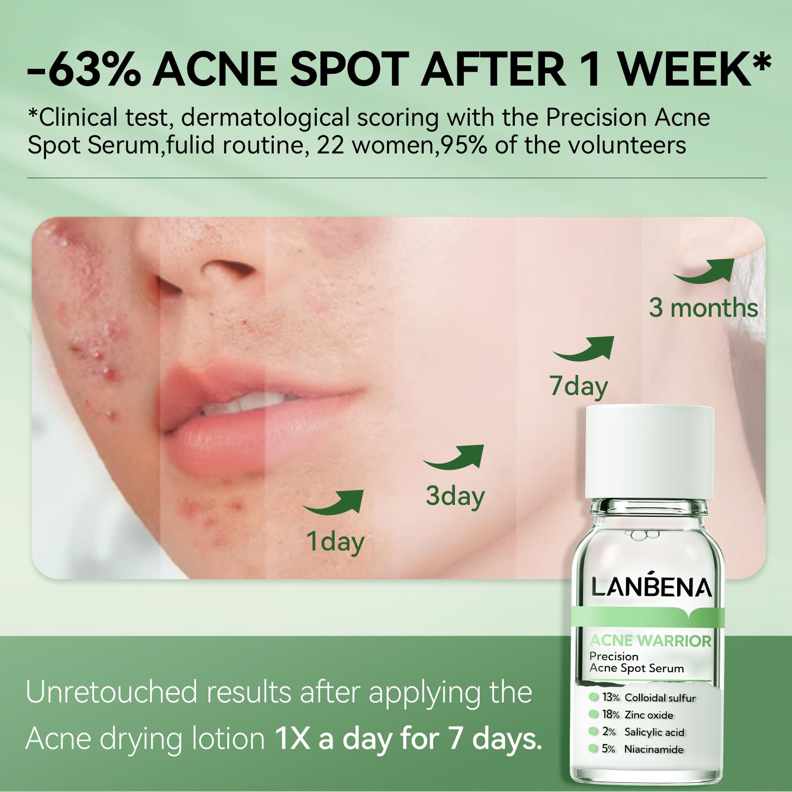LANBENA Nighttime skincare routine image highlighting easy overnight acne support