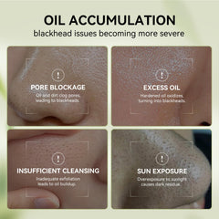 LANBENA pore-minimizing serum bottle highlights hydration and pore refinement.