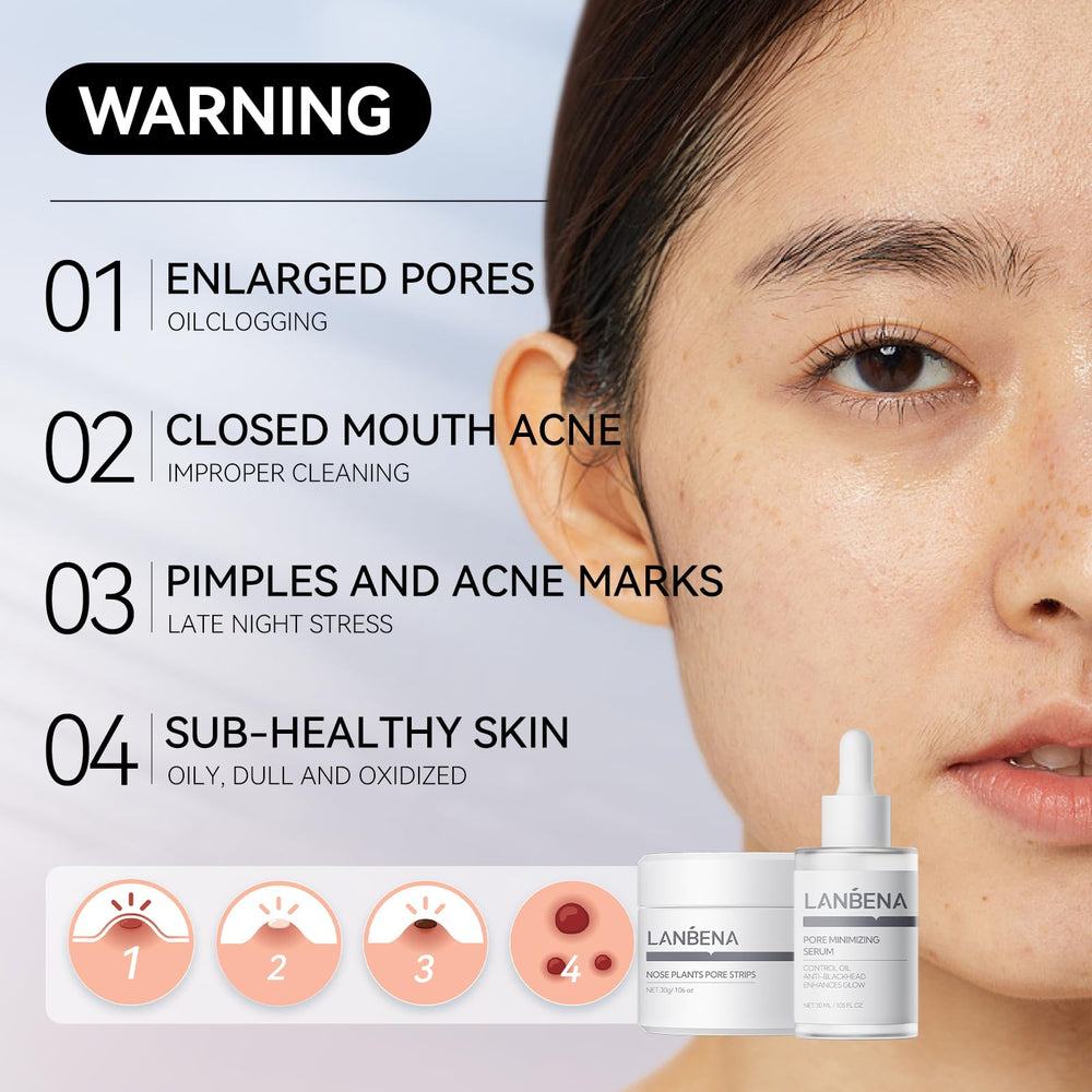 LANBENA removal paper pack ready for clean blackhead extraction