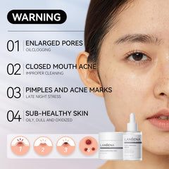 LANBENA removal paper pack ready for clean blackhead extraction