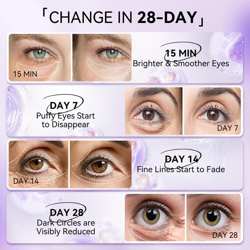 LANBENA patches deliver moisture with hyaluronic acid and ectoin.