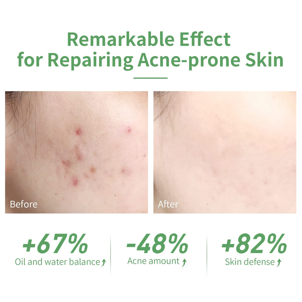 LANBENA serum dropper application shows easy, controlled dosing for routine use.
