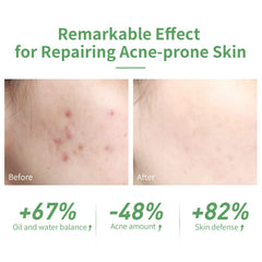 LANBENA serum dropper application shows easy, controlled dosing for routine use.