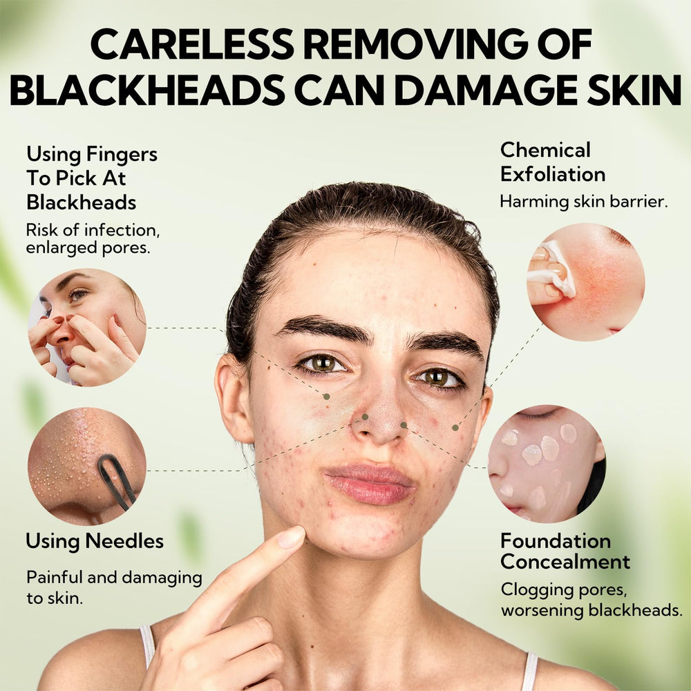 LANBENA witch hazel and aloe botanicals highlight gentle skincare