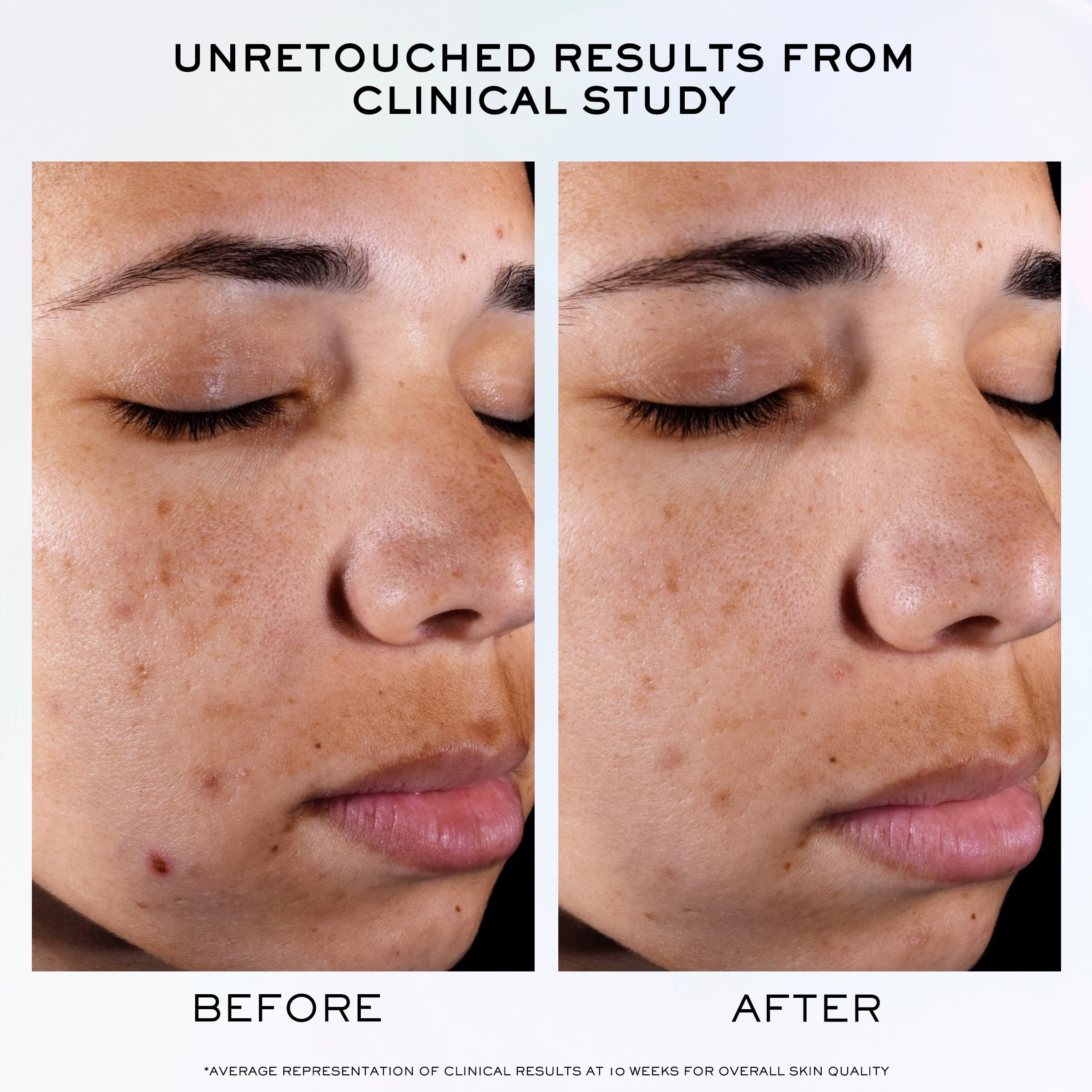 Lancôme Clarifique Pro-Solution serum application routine ready for morning or evening use.