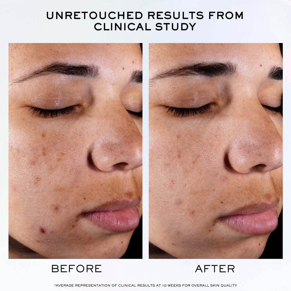 Lancôme Clarifique Pro-Solution serum application routine ready for morning or evening use.
