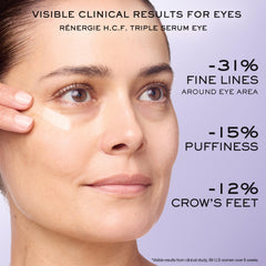 Lancôme Rénergie Eye Cream mini jar for gentle under-eye care.