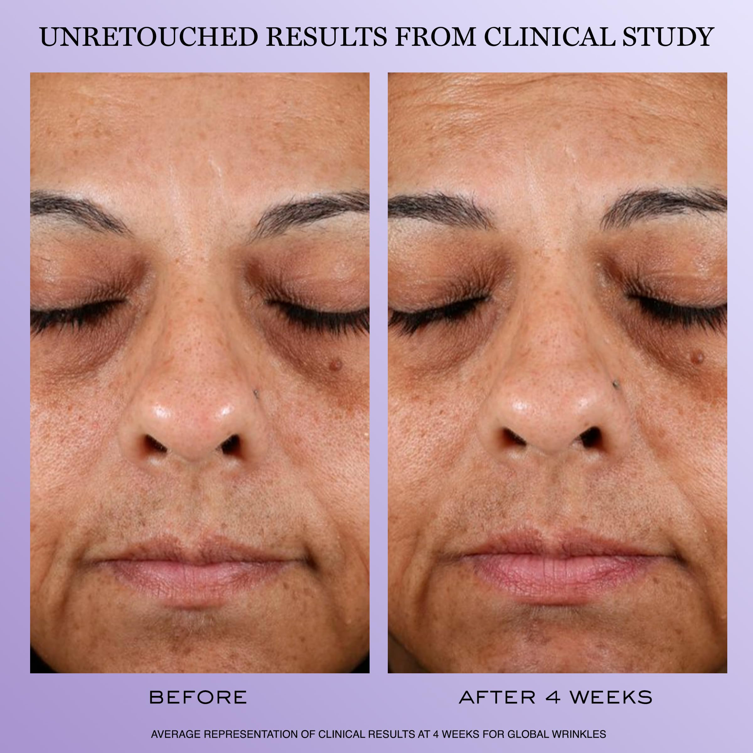 Lancôme Rénergie H.P.N. 300-Peptide jar highlights hydrating hyaluronic acid for plump skin.