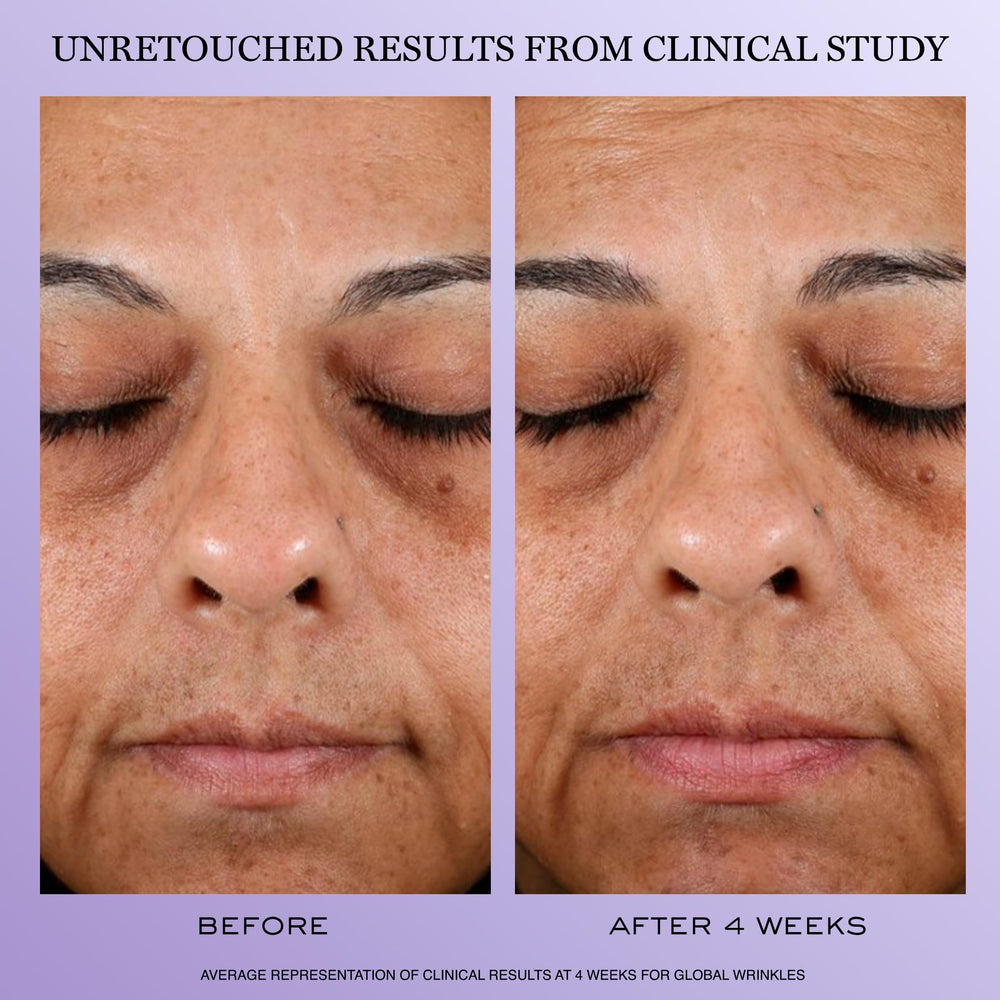 Lancôme Rénergie H.P.N. 300-Peptide jar highlights hydrating hyaluronic acid for plump skin.