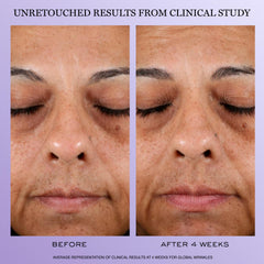 Lancôme Rénergie H.P.N. 300-Peptide jar highlights hydrating hyaluronic acid for plump skin.