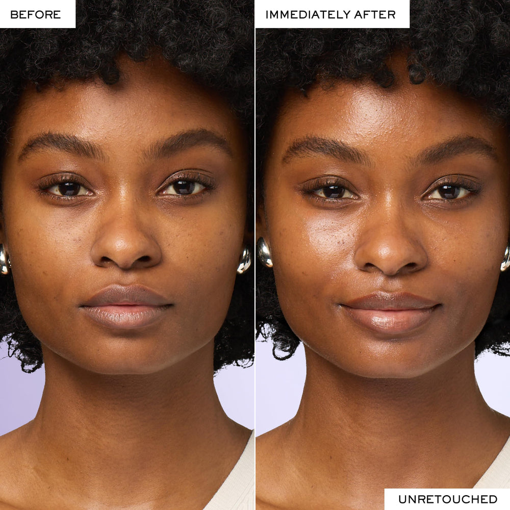 Lancôme Rénergie Lift Multi-Action SPF15 vitamin E visual emphasizing elasticity support.