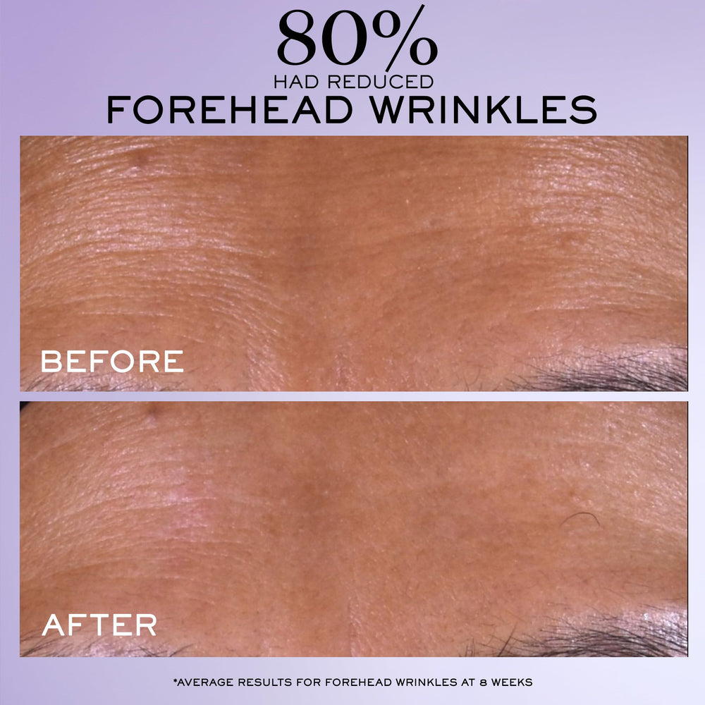 Lancôme Rénergie C.R.x serum texture swirl shows rich, smooth consistency.