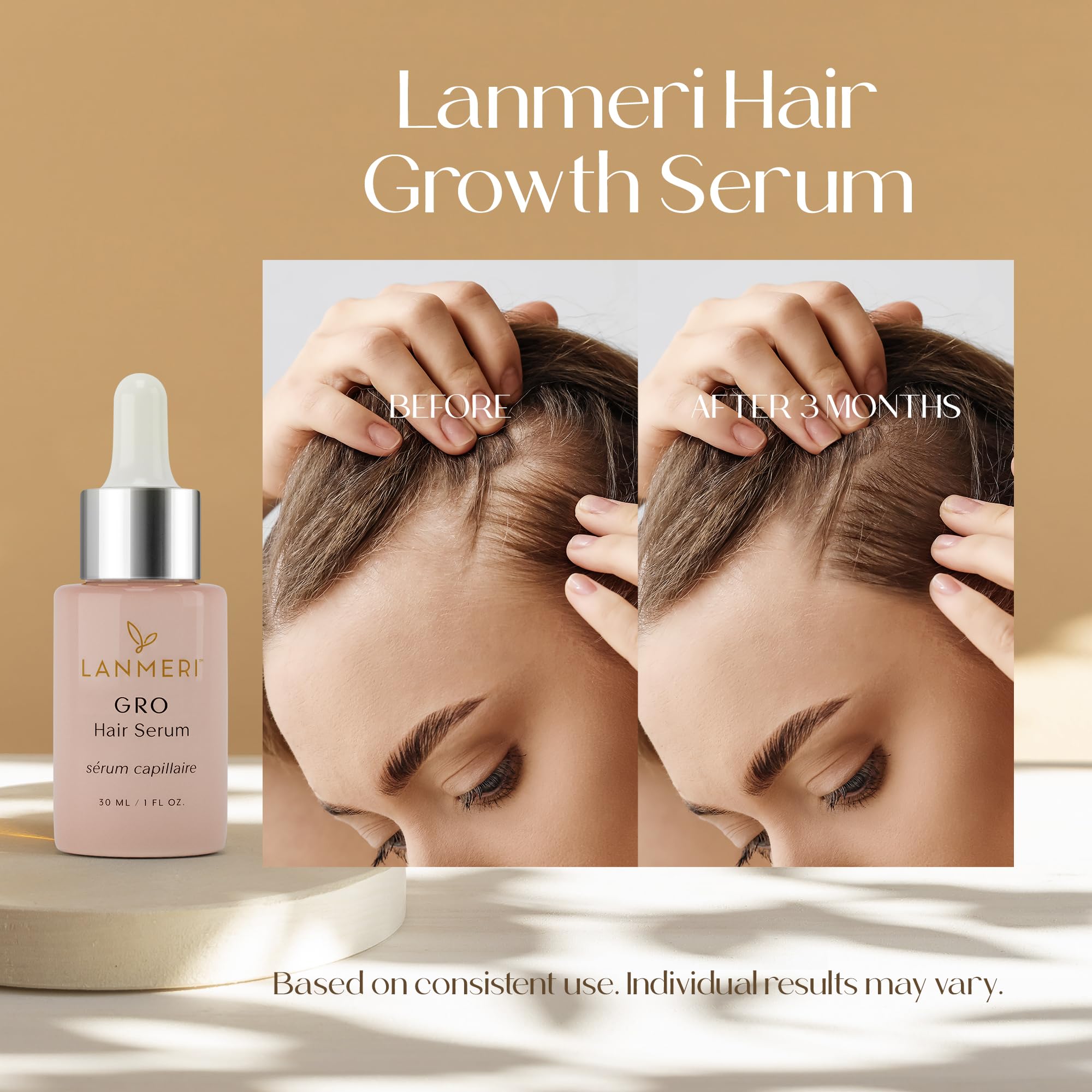 Lanmeri growth serum dropper dispensing product onto scalp for precise application.