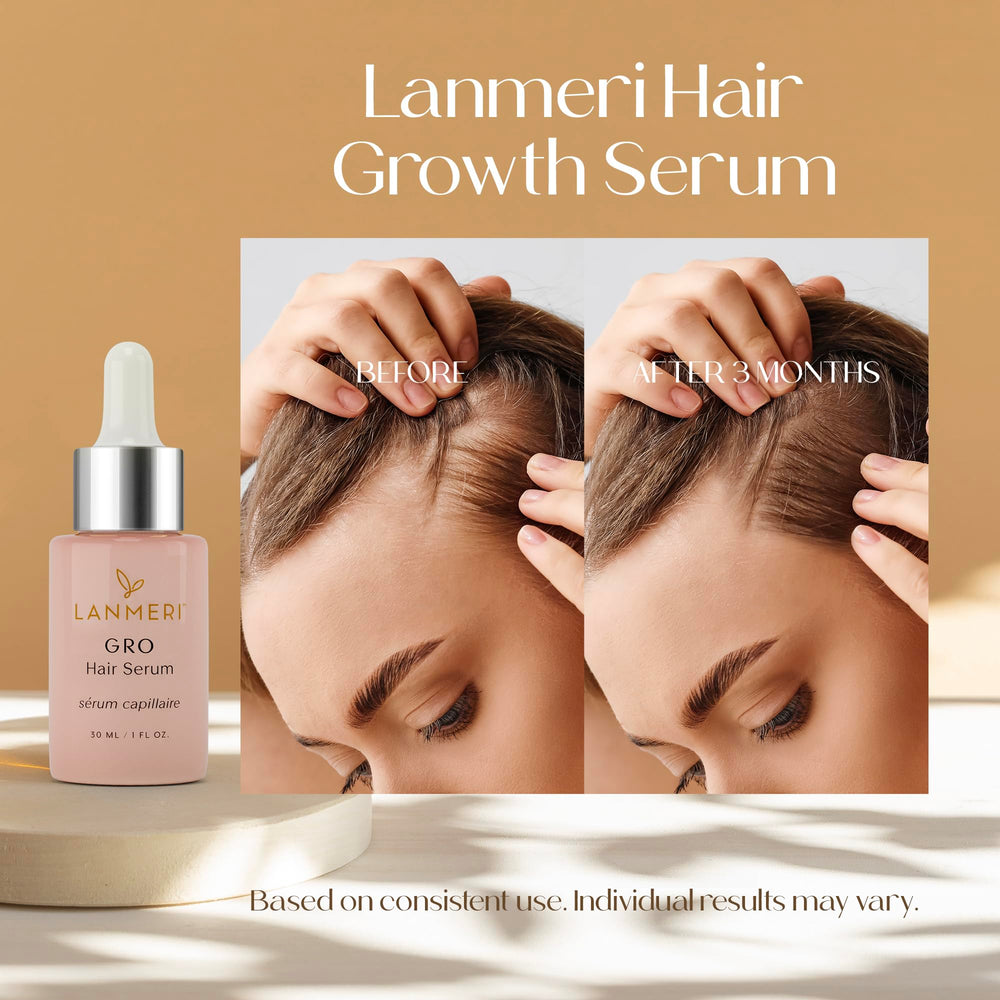 Lanmeri growth serum dropper dispensing product onto scalp for precise application.
