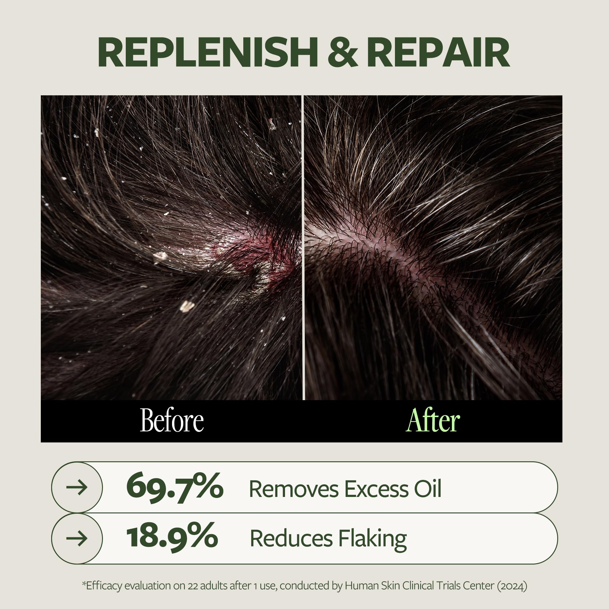 LAPCOS Dr.14 14 active ingredients visual emphasizes comprehensive scalp care.