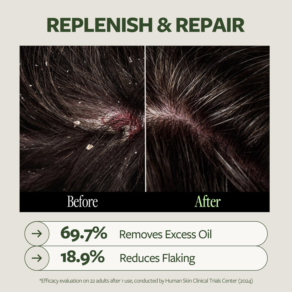 LAPCOS Dr.14 14 active ingredients visual emphasizes comprehensive scalp care.