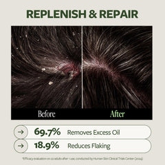 LAPCOS Dr.14 14 active ingredients visual emphasizes comprehensive scalp care.