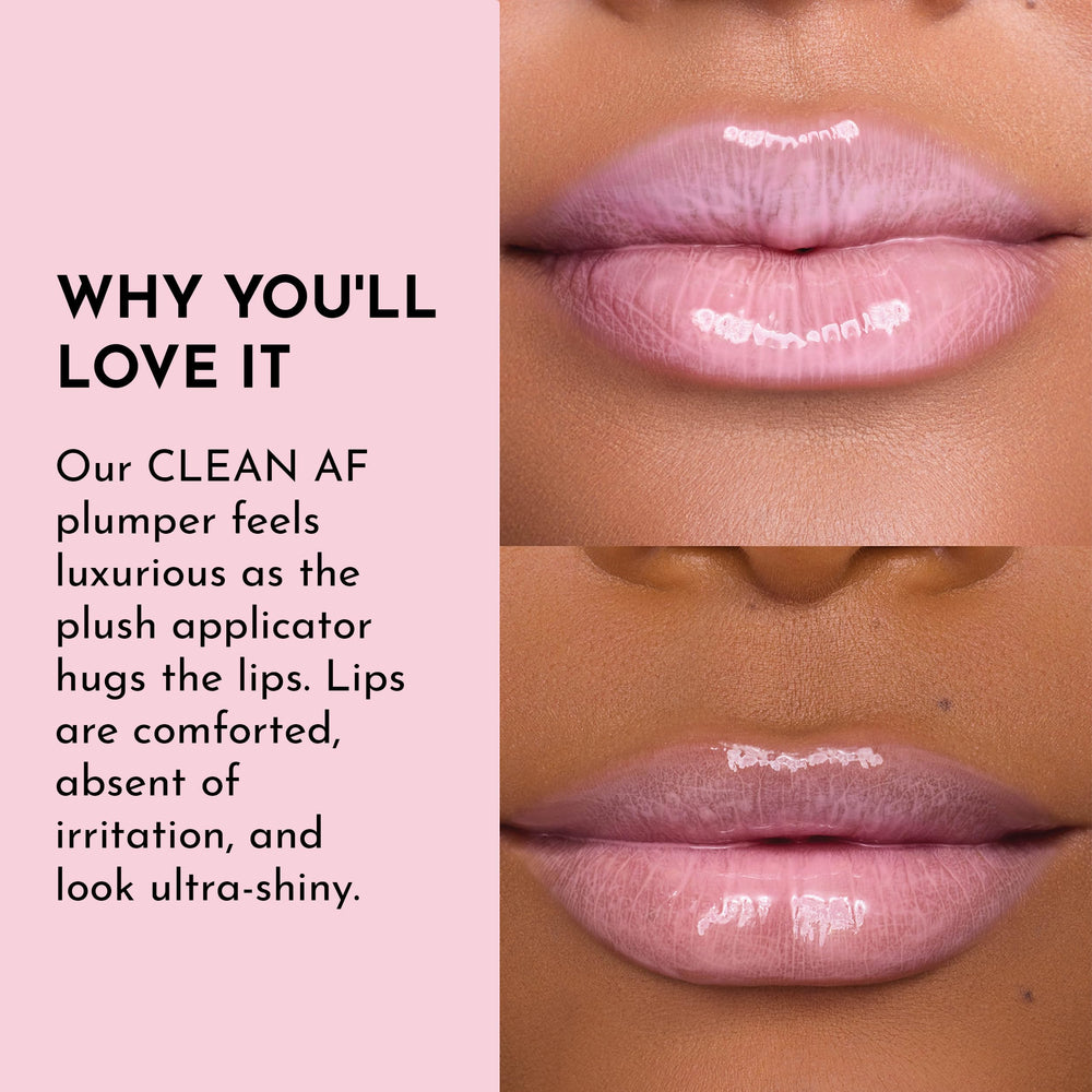 Lawless Forget the Filler close-up of hydrated lips with a glossy sheen