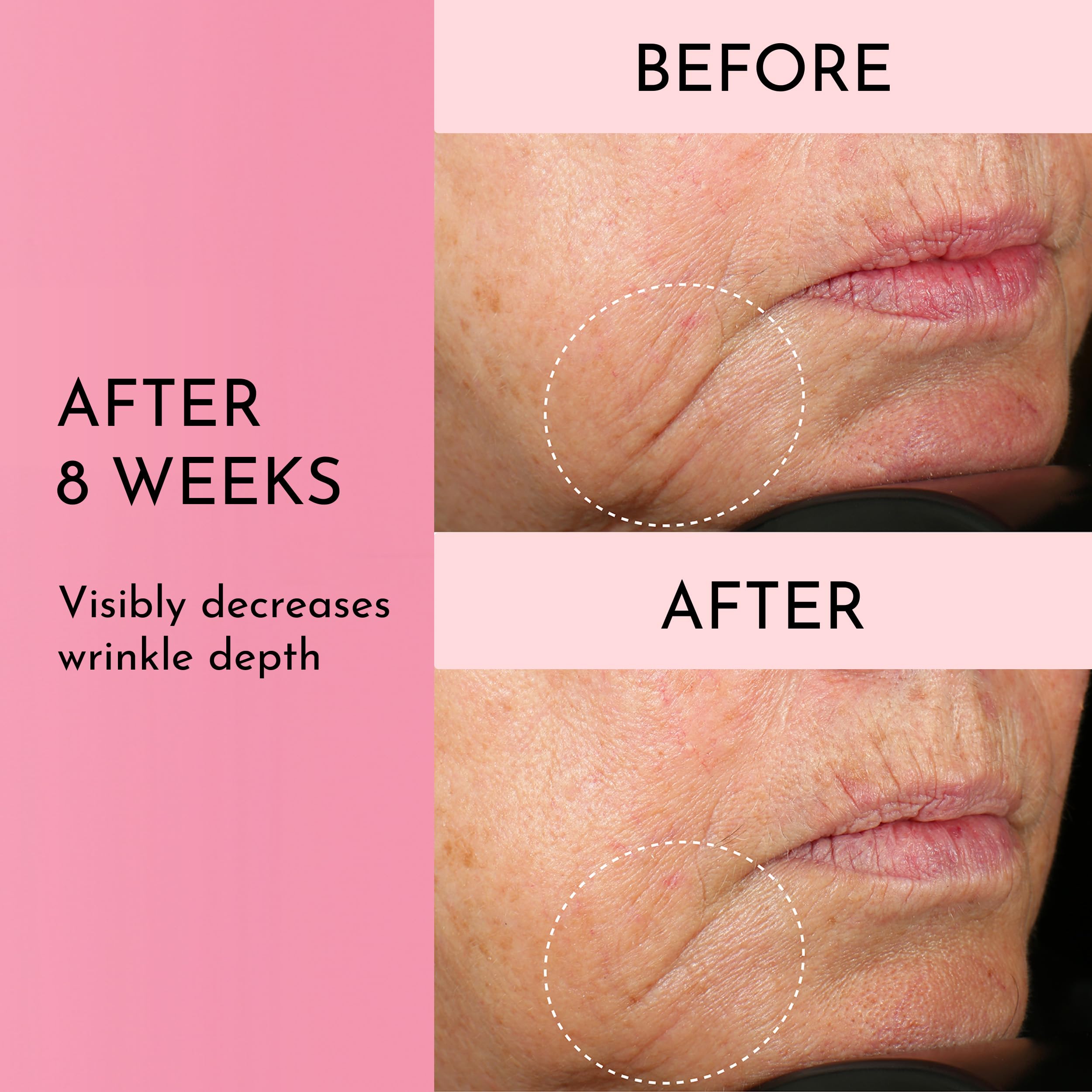 Lawless Forget the Filler texture absorbing into skin for refreshed look