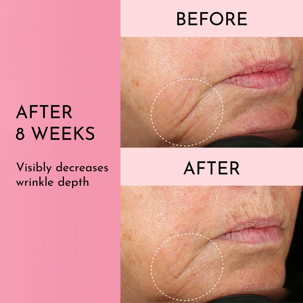 Lawless Forget the Filler texture absorbing into skin for refreshed look