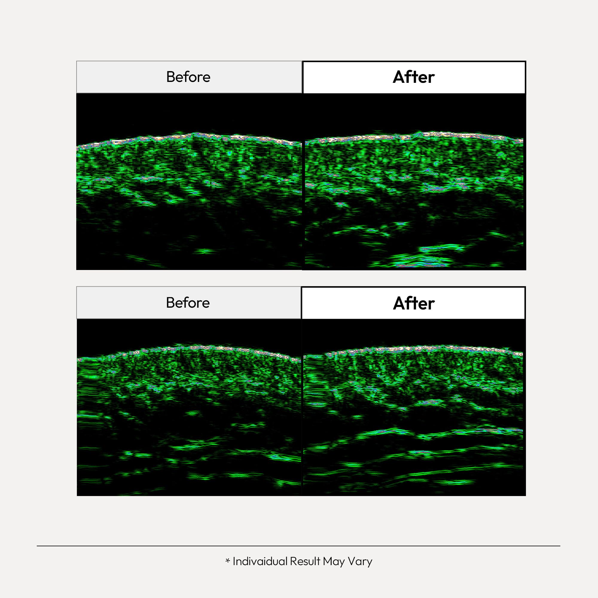 LayerLab Relayer with PDRN and peptides promotes revitalized, smoother-looking skin