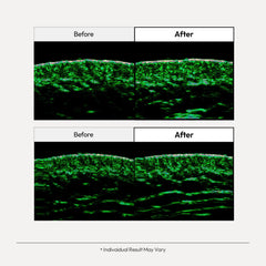 LayerLab Relayer with PDRN and peptides promotes revitalized, smoother-looking skin