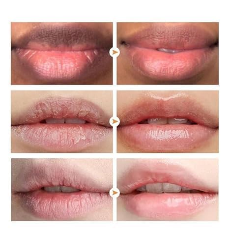 LCRORO lip care ritual in travel-friendly packaging.