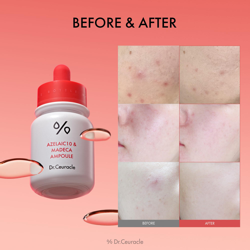 Texture légère et absorption rapide de l Ampoule Azélaïque 10% et Madecassoside.