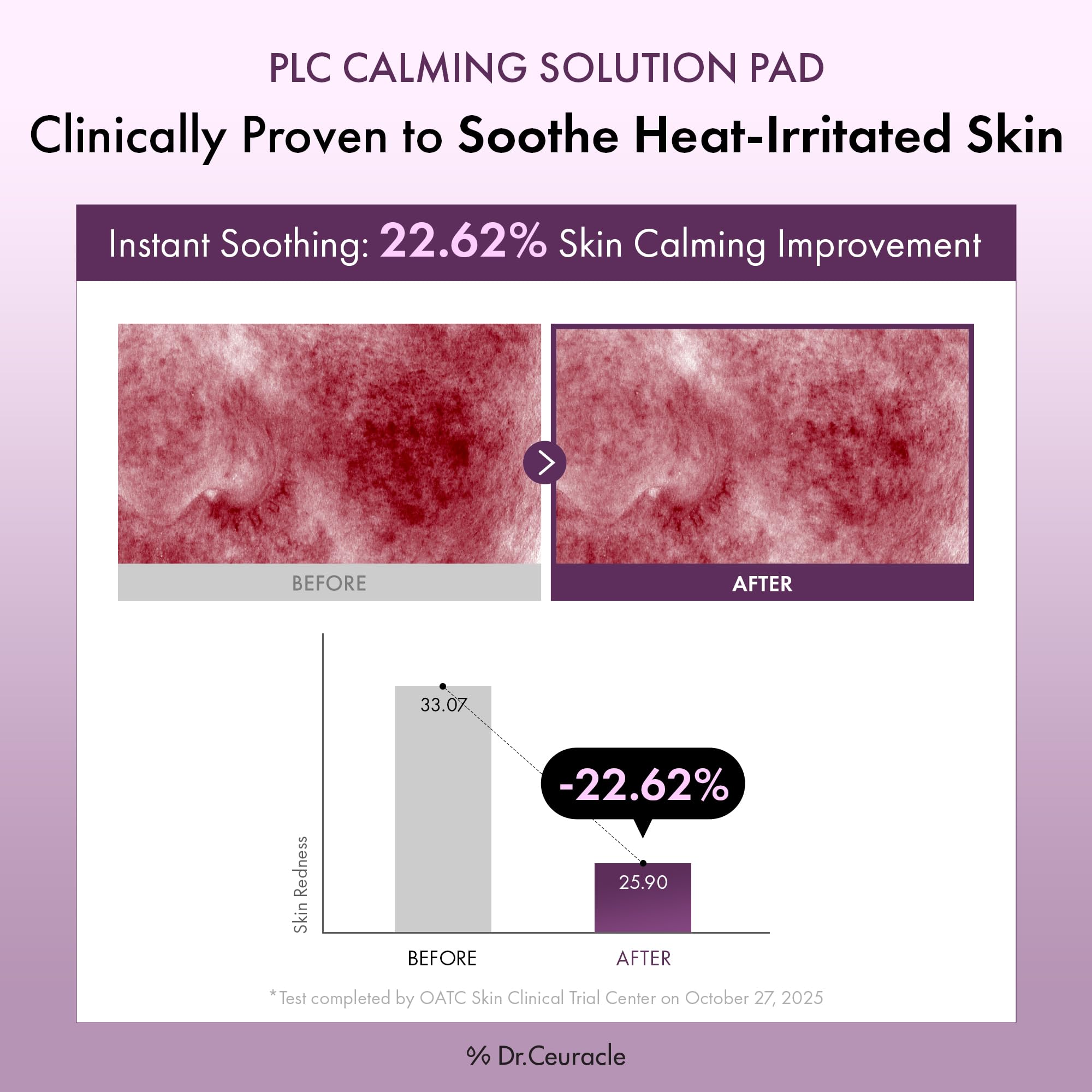 Leegeehaam PLC Calming Pad applied to the face shows gentle adhesion
