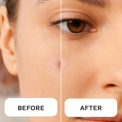 LE GUSHE hydrocolloid patch detail shows absorption and protection for blemishes.