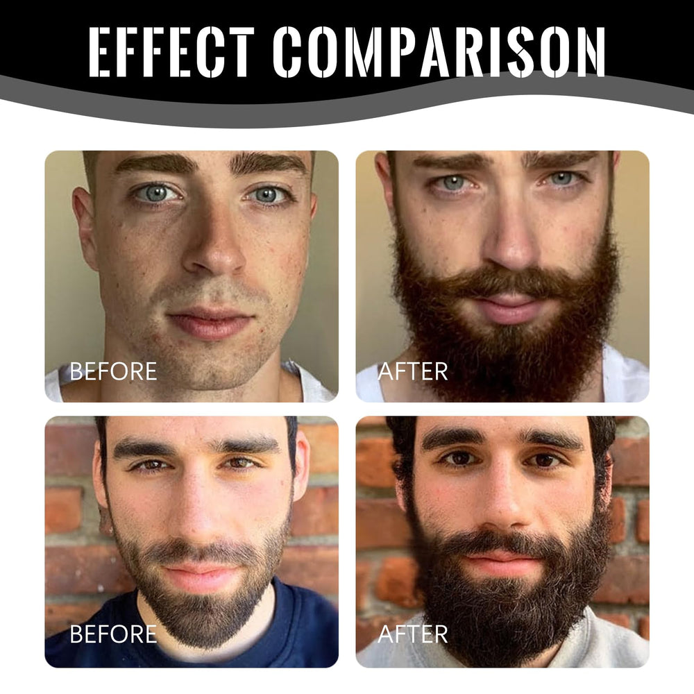 LELLURE Apollo close up of beard hairs and skin health