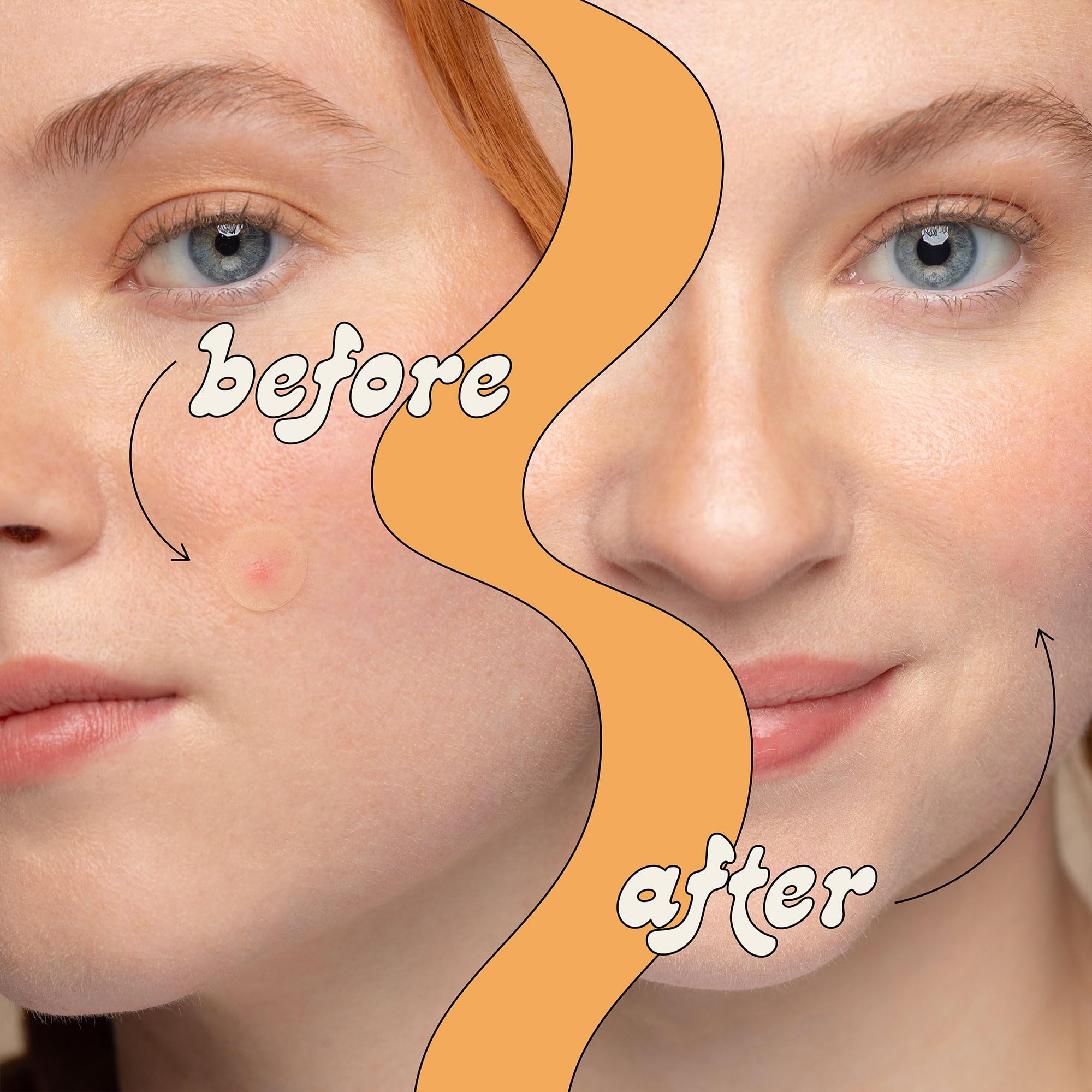 LeSpot sensitive-skin friendly patches stay gentle on delicate skin.