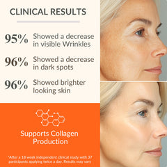 LeVaye' Vitamin C Serum dropper closeup for precise application and hydration