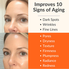 LeVaye' Vitamin C Serum ingredients rosehip oil highlighting barrier nourishment