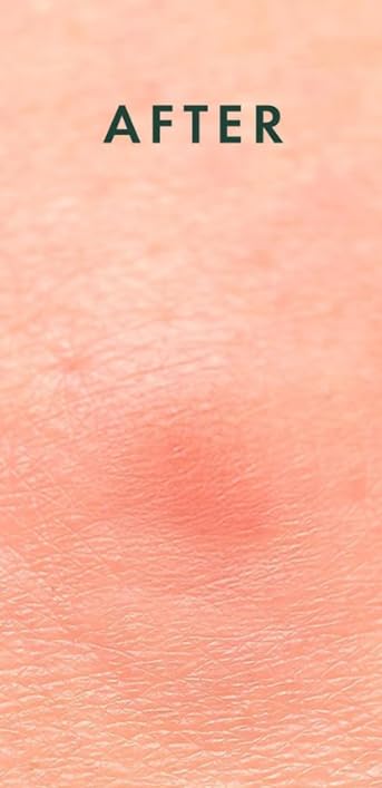 Lexie Kool Patch suitable for sensitive skin types.