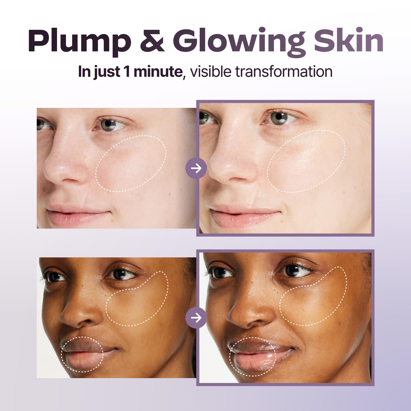 LG Pra.L red LED 630nm light for at-home anti-aging routines and improved serum uptake.