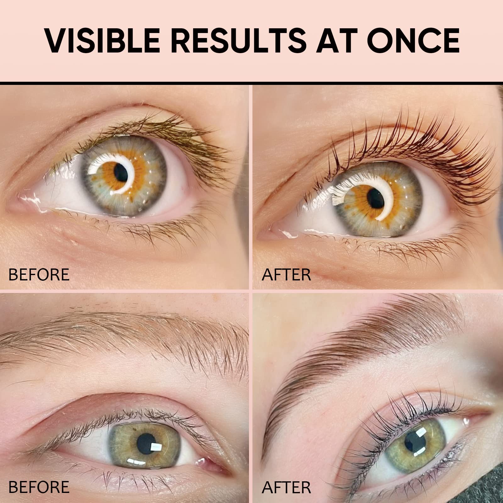 Libeauty before-and-after eyes show natural, defined results.