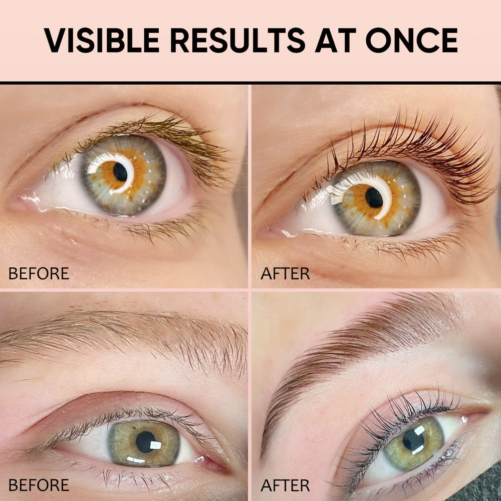Libeauty before-and-after eyes show natural, defined results.