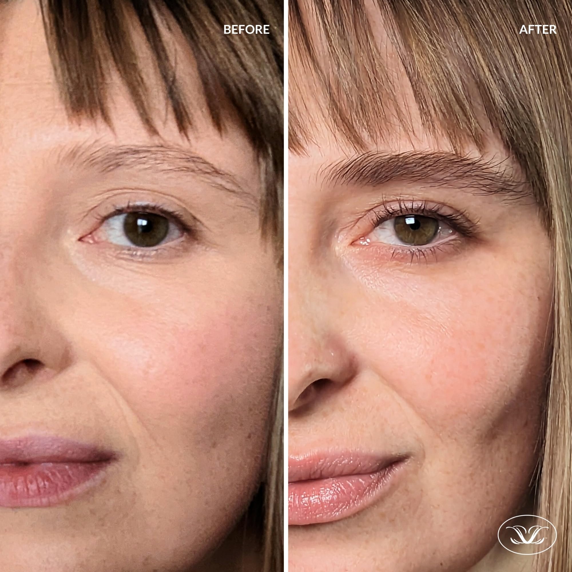 LiBrow XL daily-use scene shows long-term brow nourishment routine