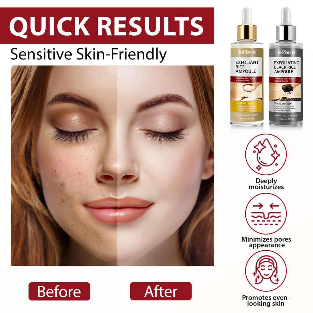 Black Rice exfoliant texture targeting pores in liiutry Glow Rice Ampoule Duo