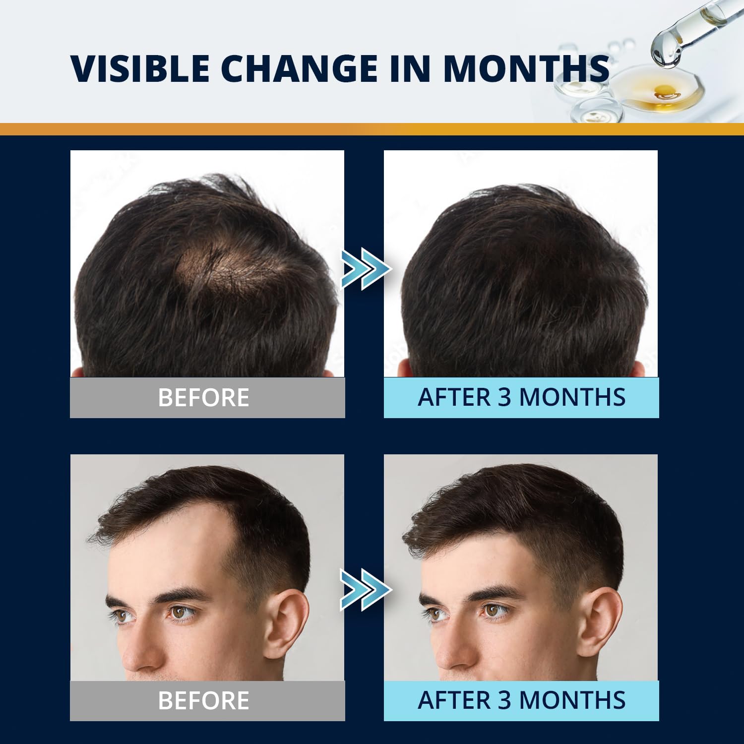 Lilivera dropper application delivers precise 1 ml doses twice daily.
