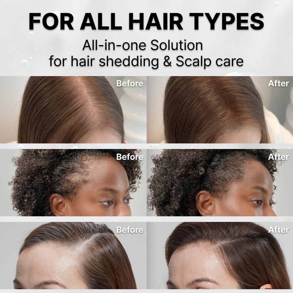 Lightweight GROWTURN serum quickly absorbing into dry hair