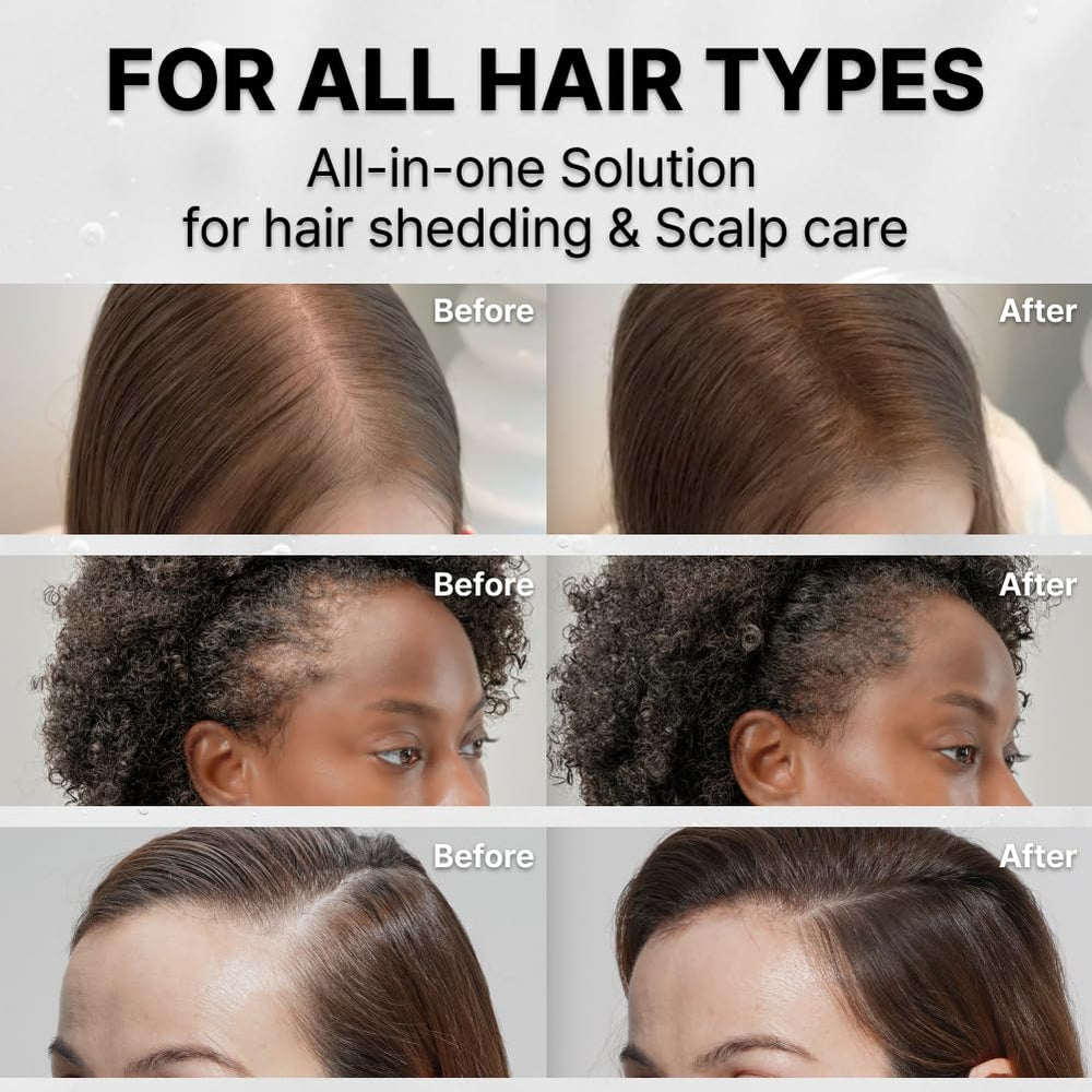 Lightweight GROWTURN serum quickly absorbing into dry hair